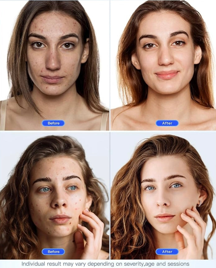 7-in-1 LED Photon Mask: Advanced Light Therapy for Comprehensive Skin Rejuvenation and Anti-Aging - Fast and Free Shipping